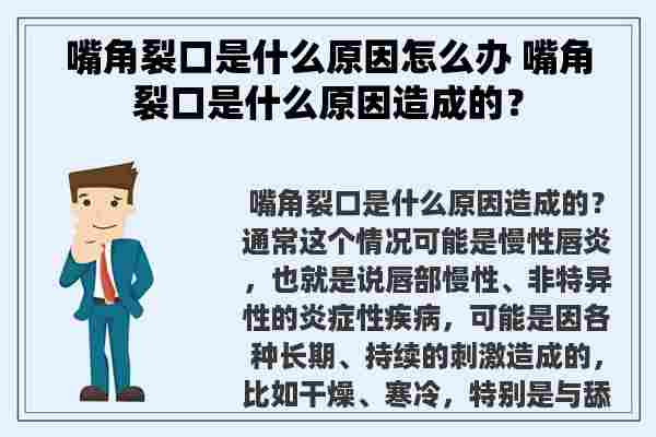 嘴角裂口是什么原因怎么办 嘴角裂口是什么原因造成的？